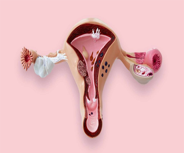 بهداشت واژن زنان